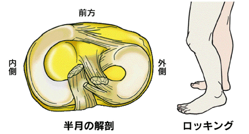 日本【膝の痛み】研究所