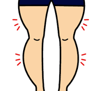 変形性膝関節症,姿勢
