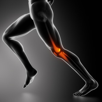 膝の痛み,解消,運動